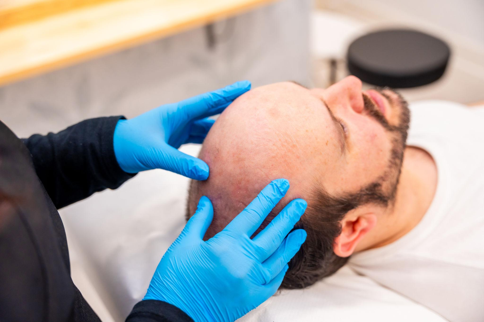 Hair Loss Diagnosis